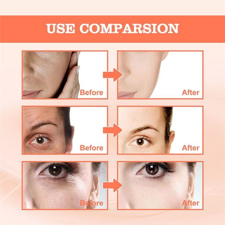 Anti-aging Pore Reduction Anti-wrinkle Serum
