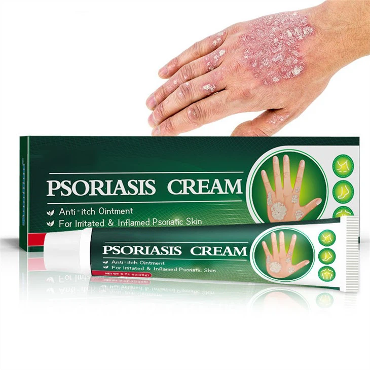 کرم پوستی کرم پسوریازیس عفونت قارچی