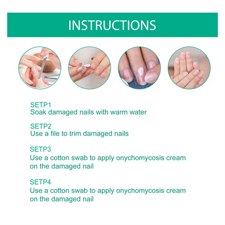 Nail Fungus Treatment Ointment